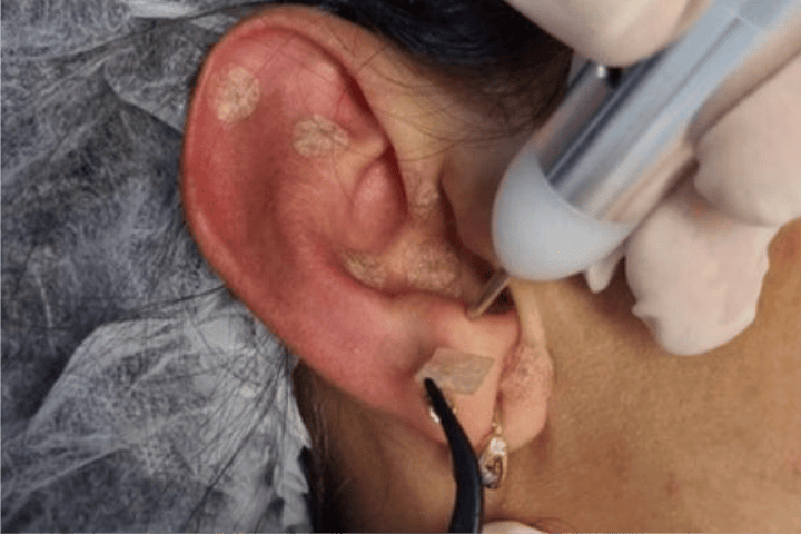 veronica_carrossel_2